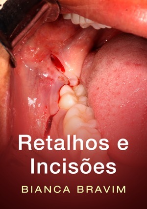 Cover for Retalhos e Incisões