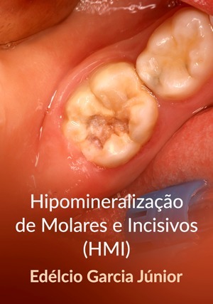 Cover for Hipomineralização de Molares e Incisivos (HMI)