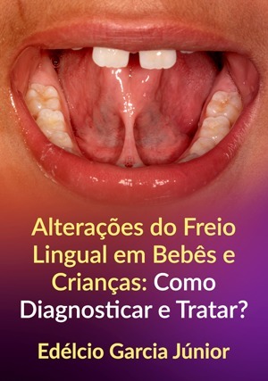 Cover for Alterações do Freio Lingual em Bebês e Crianças: Como Diagnosticar e Tratar?