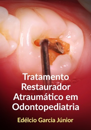 Cover for Tratamento Restaurador Atraumático em Odontopediatria