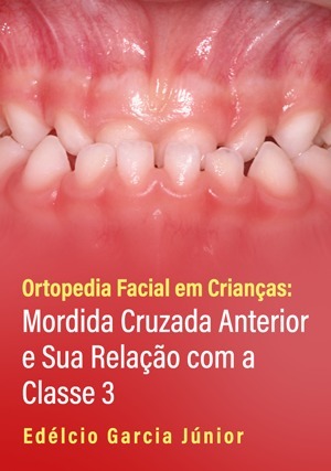 Cover for Ortopedia Facial em Crianças: Mordida Cruzada Anterior e Sua Relação com a Classe 3