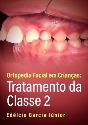 Cover for Ortopedia Facial em Crianças: Tratamento da Classe 2