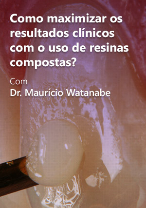 Cover for Como Maximizar os Resultados Clínicos com o Uso de Resinas Compostas