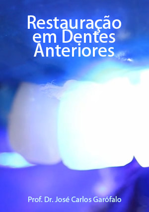 Cover for Restauração em Dentes Anteriores