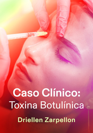 Cover for Caso Clínico: Toxina Botulínica
