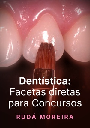 Cover for Dentística: Facetas Diretas para Concursos