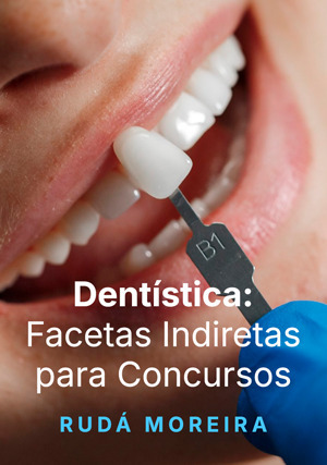 Cover for Dentística: Facetas Indiretas para Concursos