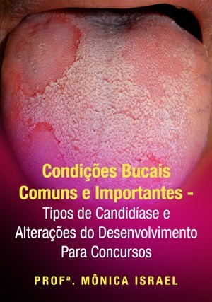 Cover for Condições Bucais Comuns e Importantes – Tipos de Candidíase e Alterações do Desenvolvimento Para Concursos