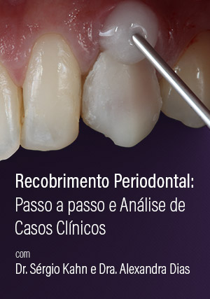 Cover for Recobrimento Periodontal: Passo a passo e Análise de Casos Clínicos