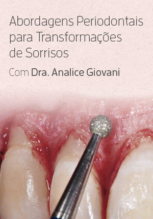 Cover for Abordagens Periodontais para Transformações de Sorrisos