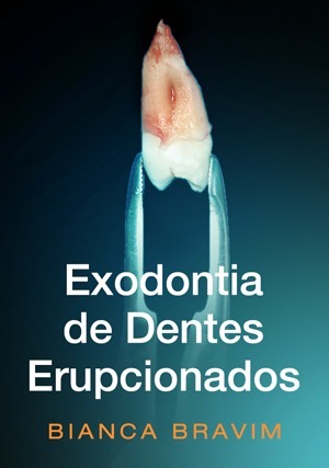 Cover for Exodontia de Dentes Erupcionados