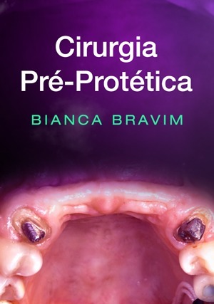 Cover for Cirurgia Pré-Protética
