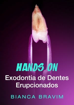 Cover for Hands On - Exodontia de Dentes Erupcionados