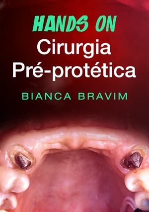 Cover for Hands On: Cirurgia Pré-protética