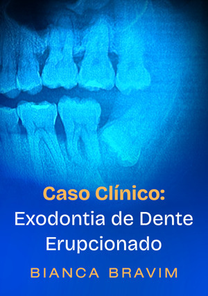 Cover for Caso Clínico: Exodontia de Dente Erupcionado