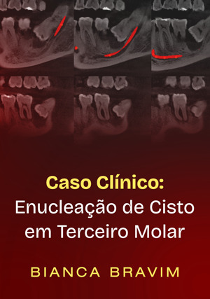 Cover for Caso Clínico: Enucleação de Cisto em Terceiro Molar