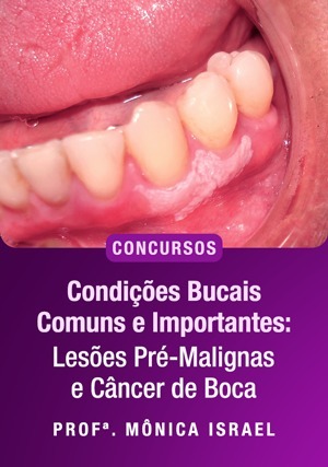 Cover for Condições Bucais Comuns e Importantes – Lesões Pré- Malignas e Câncer de Boca para Concursos