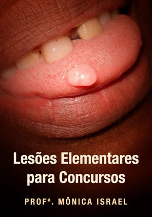 Cover for Lesões Elementares para Concursos