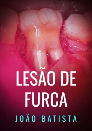Cover for Lesão de Furca