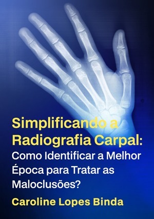 Cover for Simplificando a Radiografia Carpal: Como Identificar a Melhor Época para Tratar as Maloclusões?