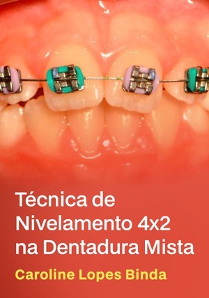 Cover for Técnica de Nivelamento 4x2 na Dentadura Mista