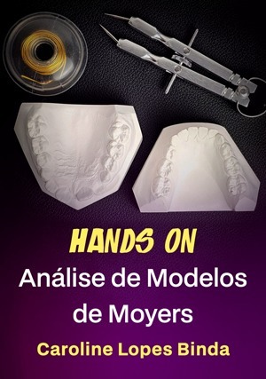Cover for Hands on: Análise de Modelos de Moyers