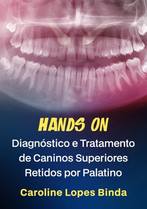 Cover for Hands on: Diagnóstico e Tratamento de Caninos Superiores Retidos por Palatino
