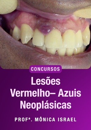 Cover for Lesões vermelho – Azuis Neoplásicas Para Concursos