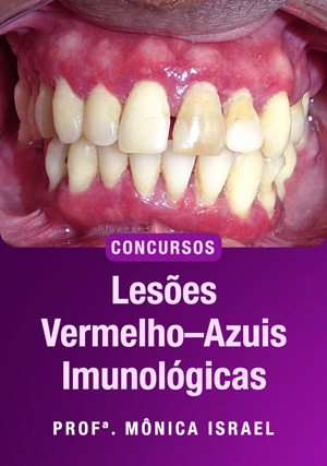 Cover for Lesões vermelho – Azuis Imunológicas Para Concursos