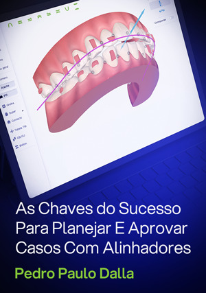 Cover for As Chaves do Sucesso Para Planejar E Aprovar Casos Com Alinhadores