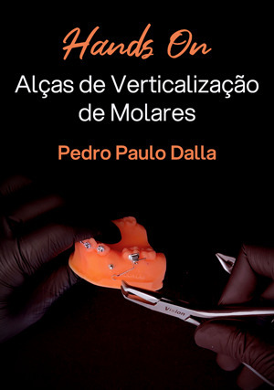 Cover for Hands on: Alças de Verticalização de Molares