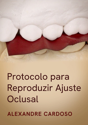 Cover for Protocolo para Reproduzir Ajuste Oclusal
