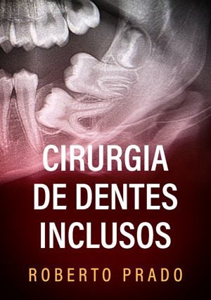 Cover for Cirurgia de Dentes Inclusos