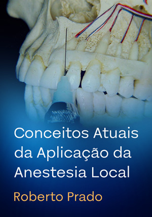 Cover for Conceitos Atuais da Aplicação da Anestesia Local
