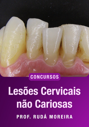 Cover for Lesões Cervicais não Cariosas para Concursos