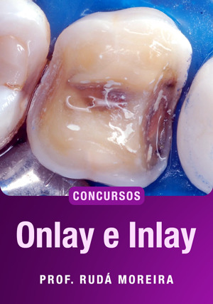 Cover for Onlay e Inlay para Concursos