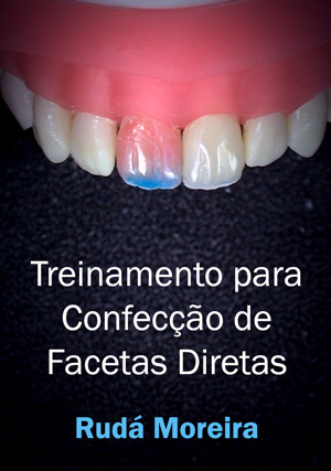 Cover for Treinamento para Confecção de Facetas Diretas