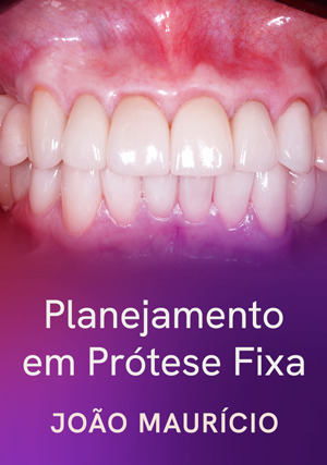 Cover for Planejamento em Prótese Fixa
