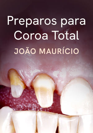 Cover for Preparos para Coroa Total