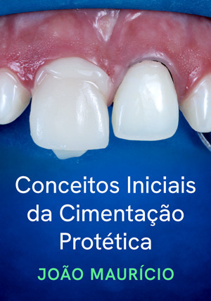 Cover for Conceitos Iniciais da Cimentação Protética