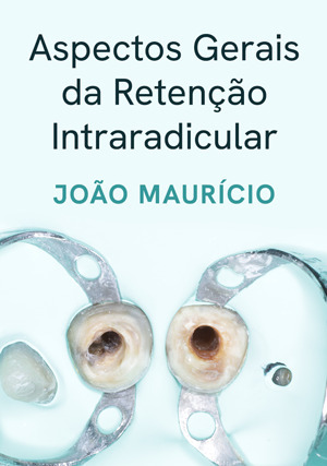 Cover for Aspectos Gerais da Retenção Intraradicular