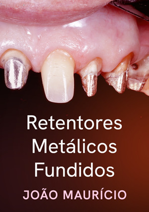Cover for Retentores Metálicos Fundidos