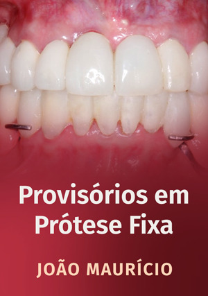 Cover for Provisórios em Prótese Fixa