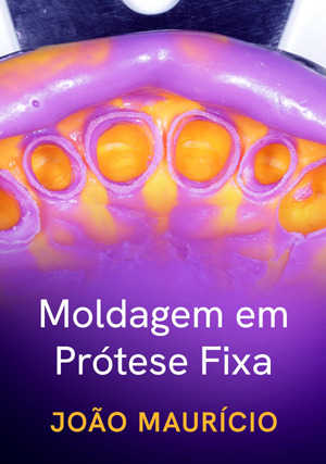 Cover for Moldagem em Prótese Fixa