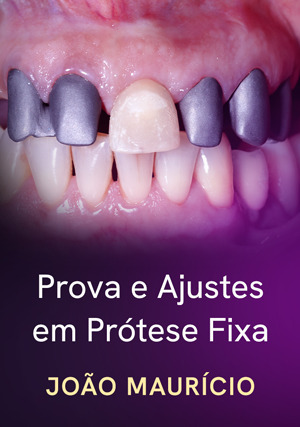 Cover for Prova e Ajustes em Prótese Fixa