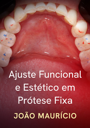 Cover for Ajuste Funcional e Estético em Prótese Fixa