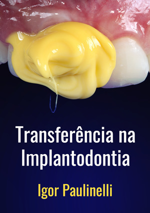 Cover for Transferência na Implantodontia