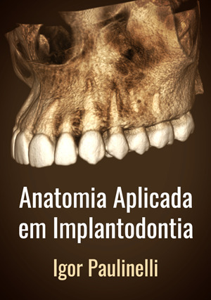 Cover for Anatomia Aplicada em Implantodontia