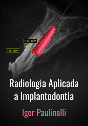 Cover for Radiologia Aplicada a Implantodontia