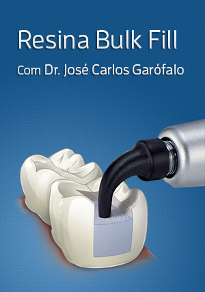 Cover for Hands On: Utilizando a técnica Bulk Fill